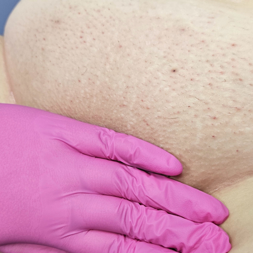 Brazilian wax — all off by Austhetics