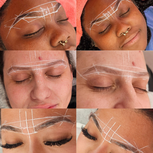 Brow mapping by Austhetics