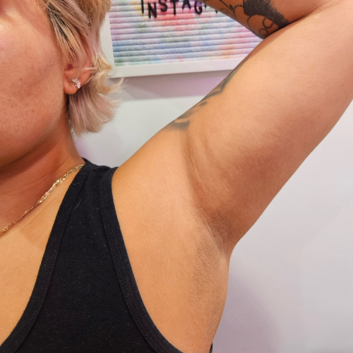 Underarm wax by Austhetics